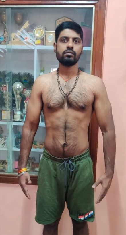 Fat loss, front: after