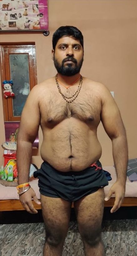 Fat loss, front: before