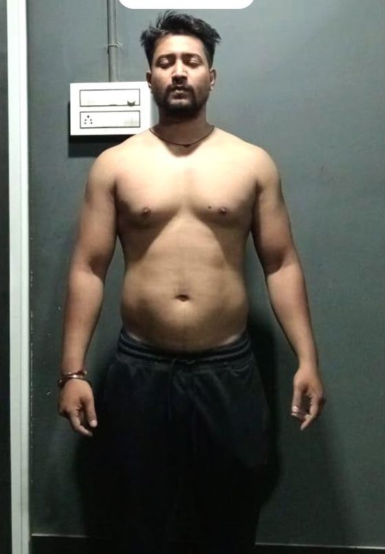 Weight loss: before