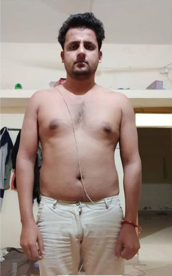 Fat loss: before