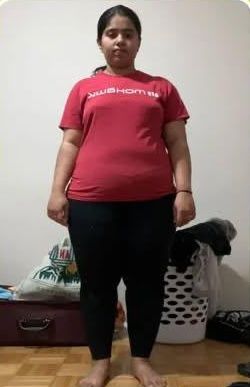 Fat loss: before